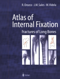 صورة الغلاف: Atlas of Internal Fixation 9783540656210