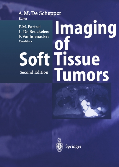 Imaging of Soft Tissue Tumors, 2nd Edition - FULL INSTANT DOWNLOAD | PDF DOCX EPUB