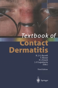 表紙画像: Textbook of Contact Dermatitis 3rd edition 9783540668428