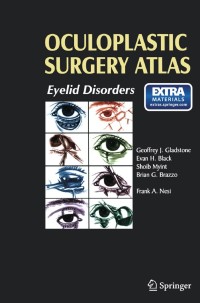 صورة الغلاف: Oculoplastic Surgery Atlas 1st edition 9783540781066
