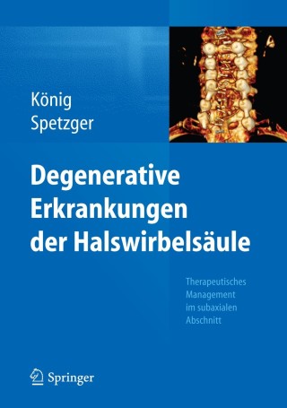 Cover image: Degenerative Erkrankungen der Halswirbelsäule 9783662435618
