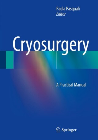 Imagen de portada: Cryosurgery 9783662439388