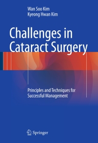 表紙画像: Challenges in Cataract Surgery 9783662460917