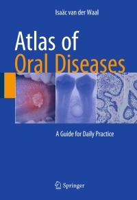 Titelbild: Atlas of Oral Diseases 9783662481219