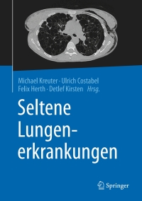 Imagen de portada: Seltene Lungenerkrankungen 9783662484180