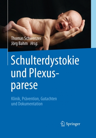 Titelbild: Schulterdystokie und Plexusparese 9783662487860