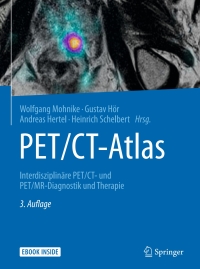 Titelbild: PET/CT-Atlas 3rd edition 9783662488416