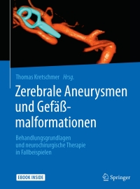 Cover image: Zerebrale Aneurysmen und Gefäßmalformationen 9783662504772