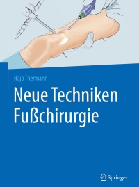 Cover image: Neue Techniken Fußchirurgie 2nd edition 9783662527368