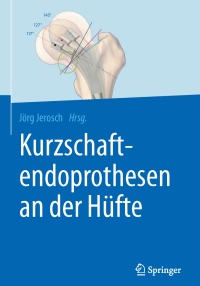 Cover image: Kurzschaftendoprothesen an der Hüfte 9783662527436