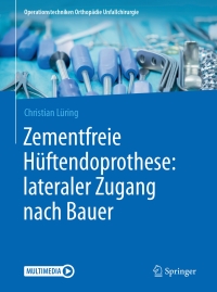 表紙画像: Zementfreie Hüftendoprothese: lateraler Zugang nach Bauer 9783662532966