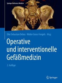 Imagen de portada: Operative und interventionelle Gefäßmedizin 2nd edition 9783662533789