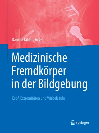 Imagen de portada: Medizinische Fremdkörper in der Bildgebung 9783662537497