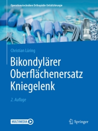Imagen de portada: Bikondylärer Oberflächenersatz Kniegelenk 2nd edition 9783662544365