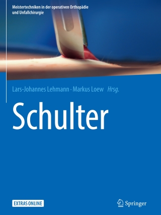 Imagen de portada: Schulter 9783662547458