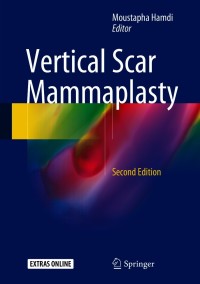 Imagen de portada: Vertical Scar Mammaplasty 2nd edition 9783662554494