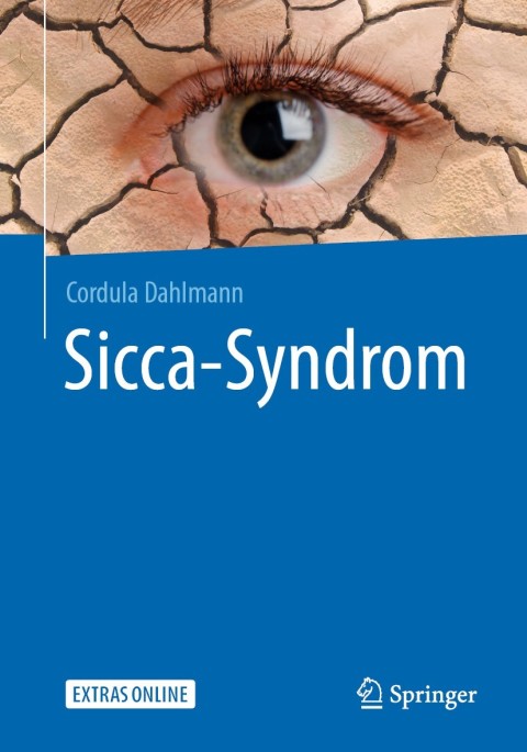 Sicca-Syndrom - FULL INSTANT DOWNLOAD | PDF DOCX EPUB