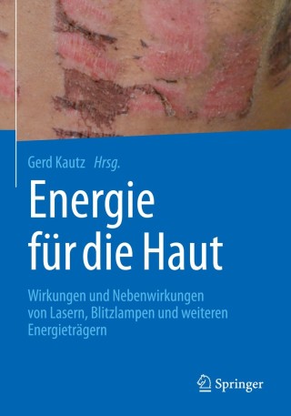 Cover image: Energie für die Haut 9783662564356