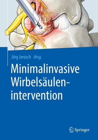 Cover image: Minimalinvasive Wirbelsäulenintervention 9783662580936