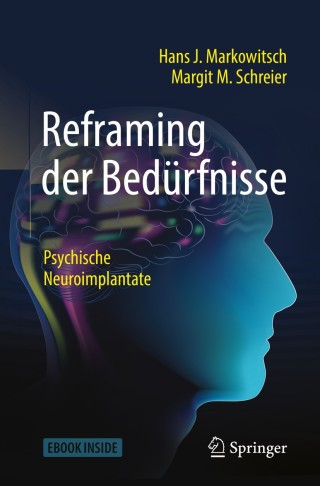 Cover image: Reframing der Bedürfnisse 9783662582640