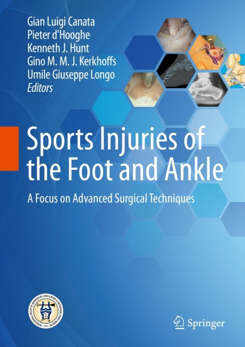 Sports Injuries of the Foot and Ankle: A Focus on Advanced Surgical Techniques - FULL INSTANT DOWNLOAD | PDF DOCX EPUB