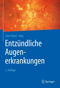 Cover image: Entzündliche Augenerkrankungen 2nd edition 9783662603987