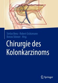 Cover image: Chirurgie des Kolonkarzinoms 9783662604526
