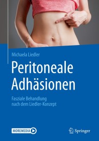Imagen de portada: Peritoneale Adhäsionen 9783662604991
