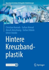 Cover image: Hintere Kreuzbandplastik 9783662619803