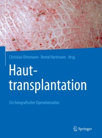 表紙画像: Hauttransplantation 9783662620595