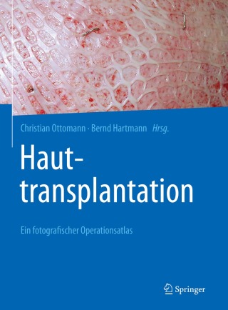 Titelbild: Hauttransplantation 9783662620595