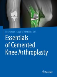 Cover image: Essentials of Cemented Knee Arthroplasty 9783662631126