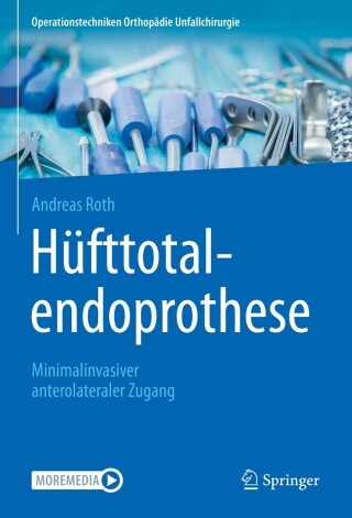 Cover image: Hüfttotalendoprothese: minimalinvasiver anterolateraler Zugang 9783662632208