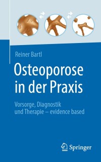 Cover image: Osteoporose in der Praxis 9783662642061