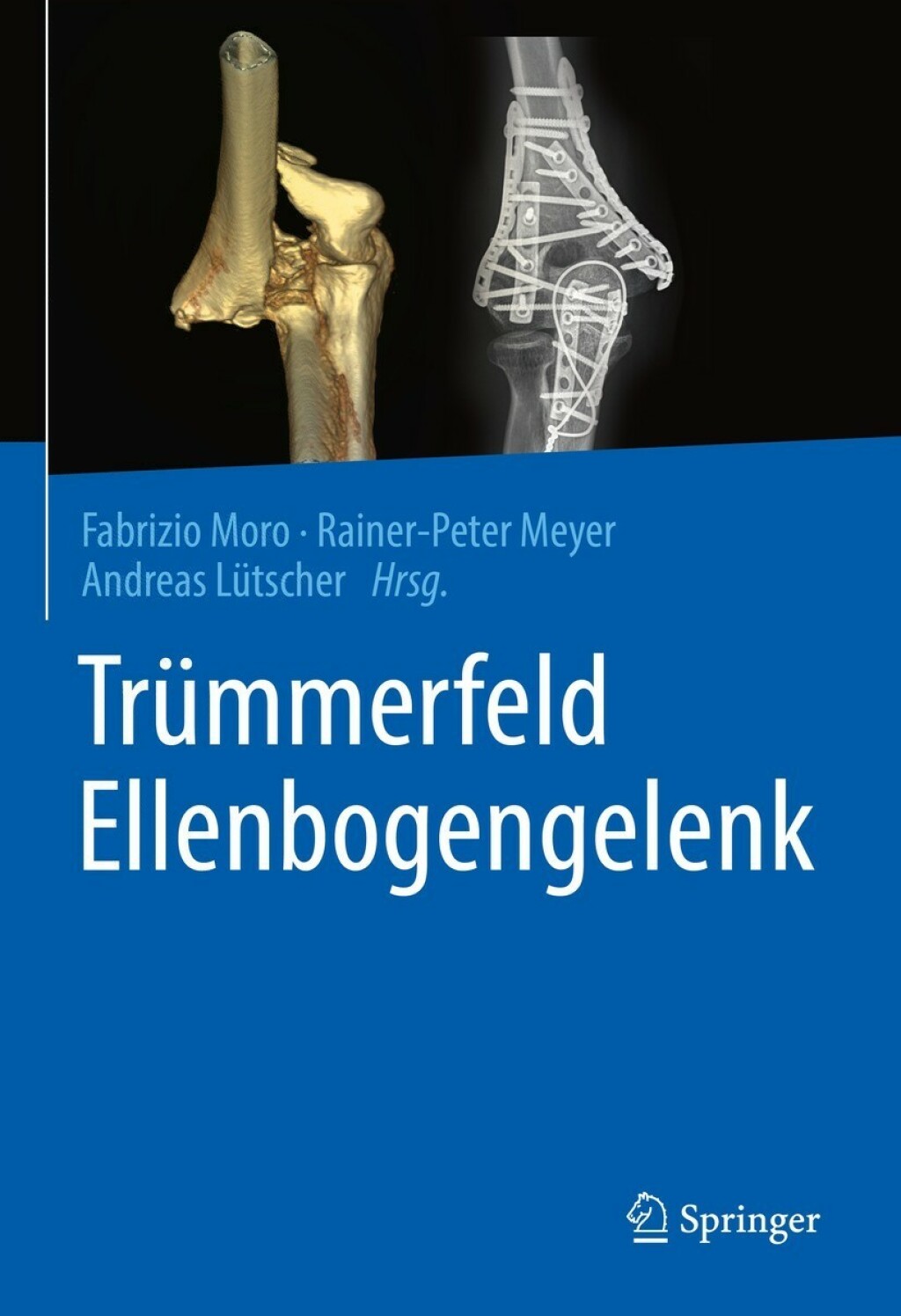 ISBN 9783662645376 product image for Trümmerfeld Ellenbogengelenk (eBook Rental) | upcitemdb.com