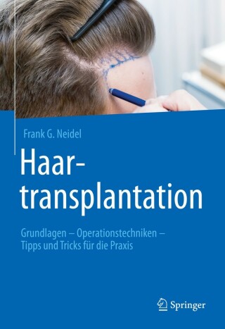 Imagen de portada: Haartransplantation 9783662648520