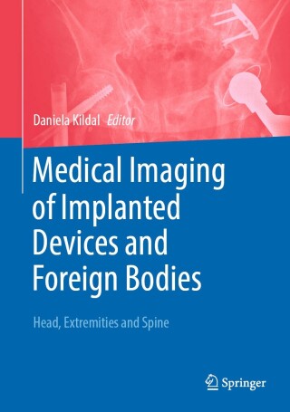 Cover image: Medical Imaging of Implanted Devices and Foreign Bodies 9783662654484