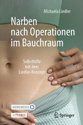 Cover image: Narben nach Operationen im Bauchraum 9783662684818