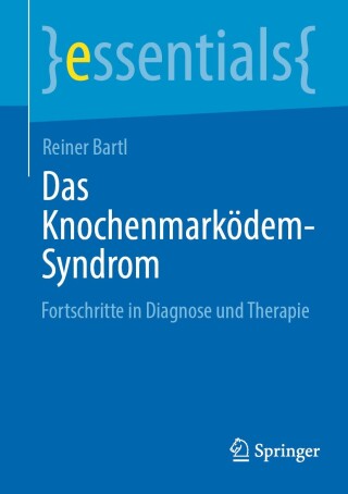 Cover image: Das Knochenmarködem-Syndrom 9783662690130