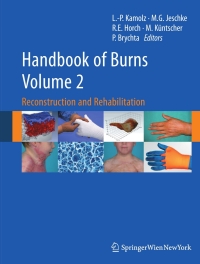 Titelbild: Handbook of Burns Volume 2 9783709103142