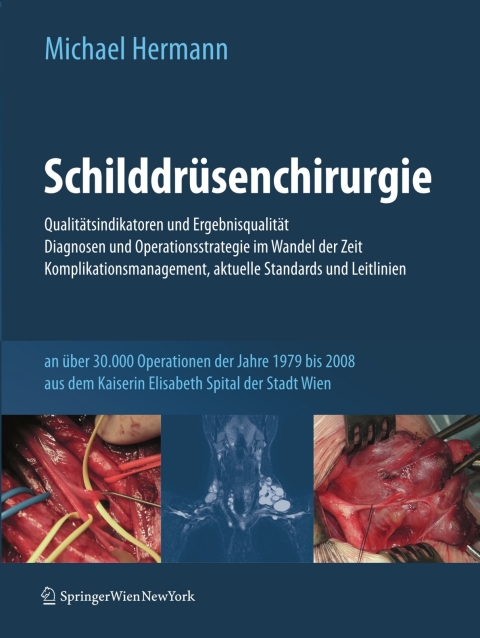 Schilddrüsenchirurgie - Qualitätsindikatoren und Ergebnisqualität, Diagnosen und Operationsstrategie im Wandel der Zeit, Komplikationsmanagement, aktuelle Standards und Leitlinien: an über 30.000 Operationen der Jahre 1979-2008 aus dem Kaiserin Elisabeth Spital der Stadt Wien - FULL INSTANT DOWNLOAD | PDF DOCX EPUB