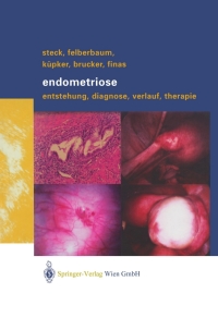 表紙画像: Endometriose 9783211007464