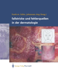 Immagine di copertina: Fallstricke und Fehlerquellen in der Dermatologie 1st edition 9783211838174