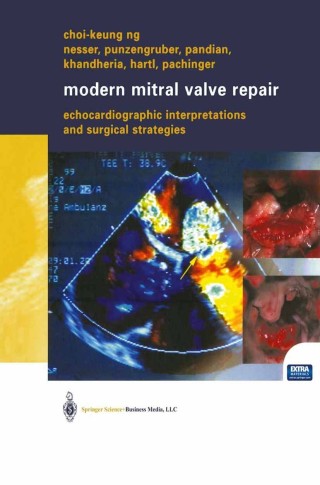 Cover image: Modern Mitral Valve Repair 9783211008607