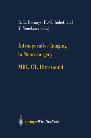 Immagine di copertina: Intraoperative Imaging in Neurosurgery 1st edition 9783211838358