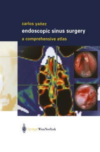 Omslagafbeelding: Endoscopic Sinus Surgery 9783709172797