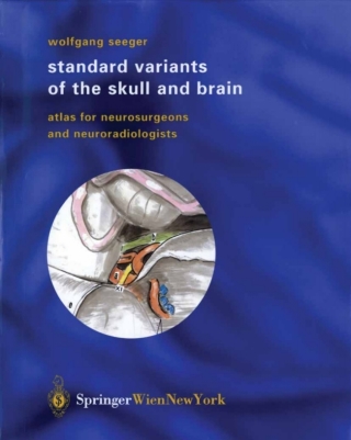 Omslagafbeelding: Standard Variants of the Skull and Brain 9783709172247