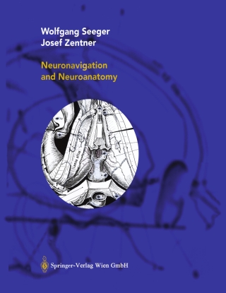 Cover image: Neuronavigation and Neuroanatomy 9783211837412