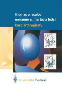 Titelbild: Knee Arthroplasty 1st edition 9783211835319