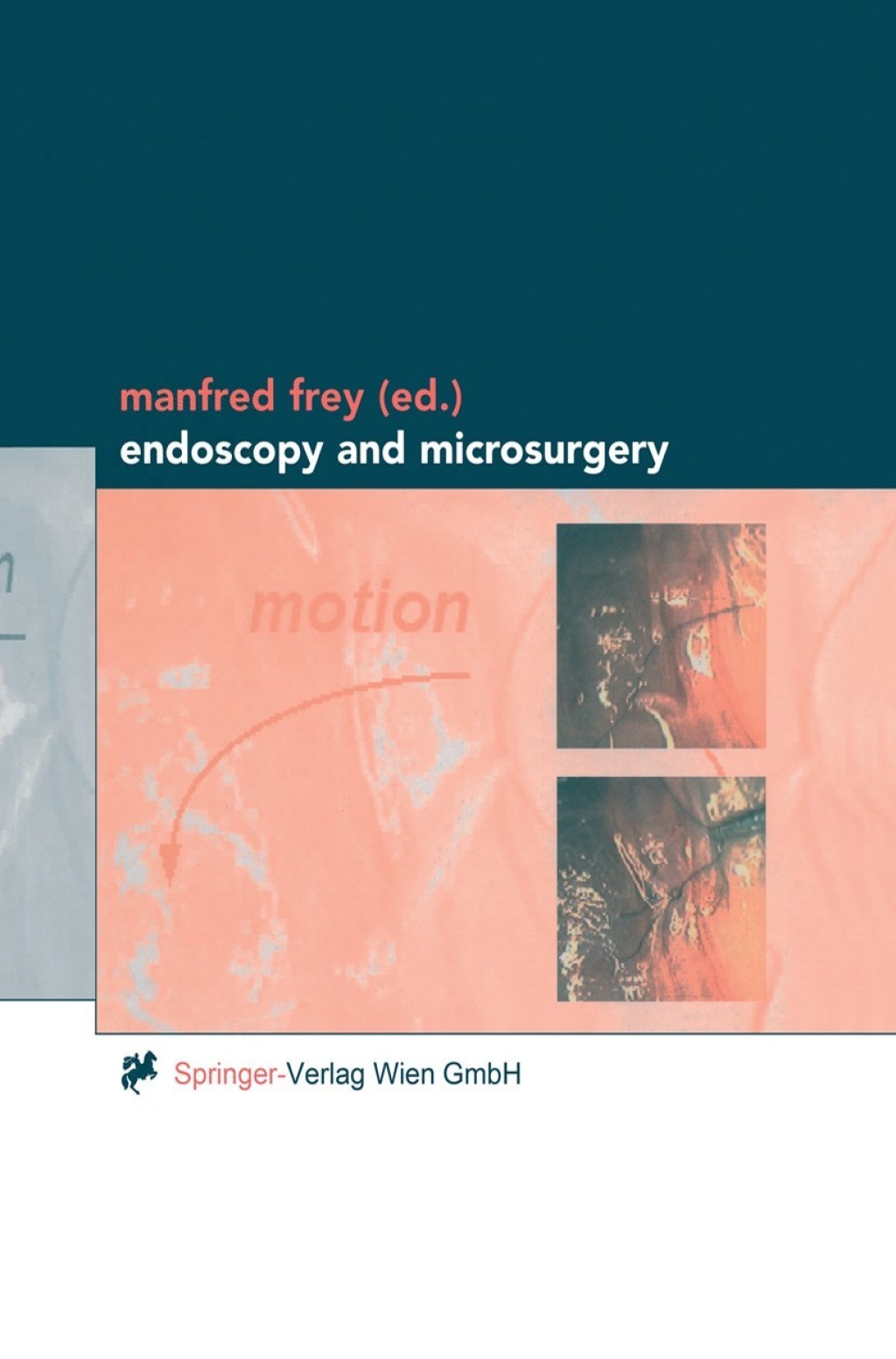 Endoscopy and Microsurgery 1st Edition